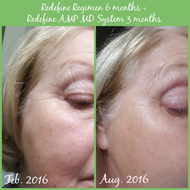 Before and after photos of using the redefine regimen by rodan and fields